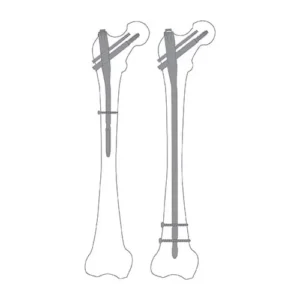 TFN/PFN Nailing System