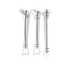 Aduera Expert Tibia & Femur Nailing System