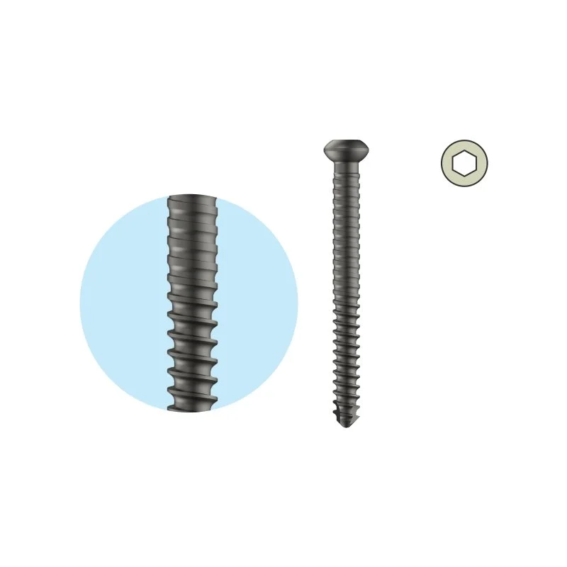 Dual Core Locking Bolt Dia. 4.7mm – Self Tapping