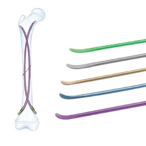 Titanium Elastic Nailing System