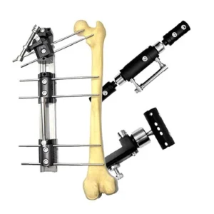 Zailfix LRS EX-FIX SYSTEM