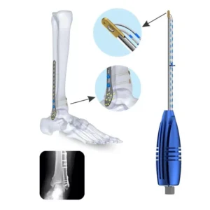 Flex Rope for Syndesmosis Repair, titanium – Sterile